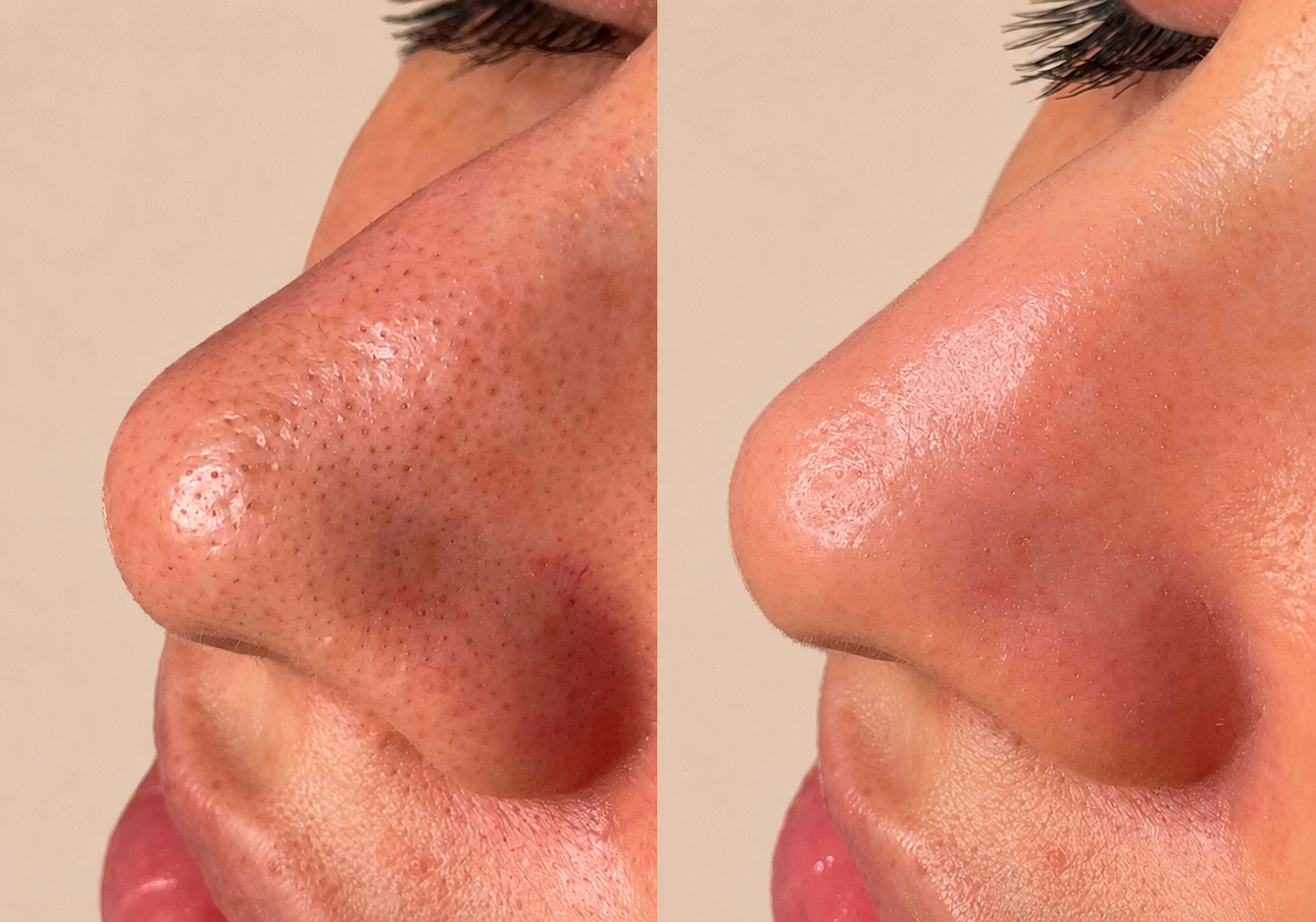 HydraGlass™ Longevity Pads