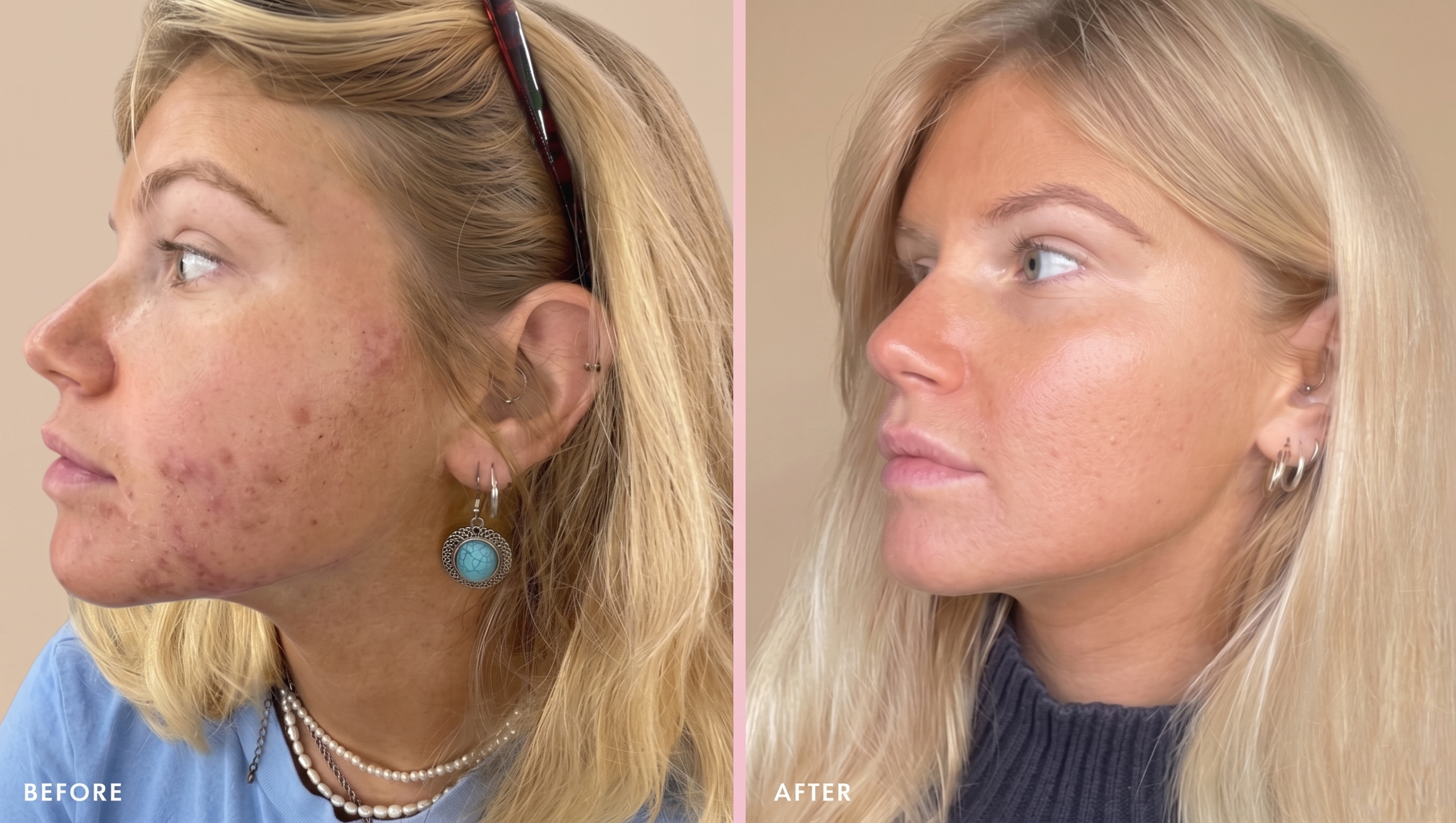 HydraGlass™ Cleanser