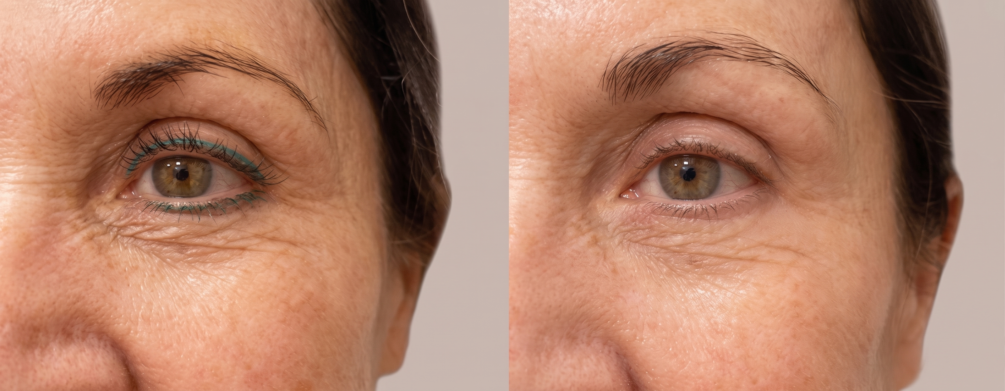 HydraGlass™ Eye Lift Cream